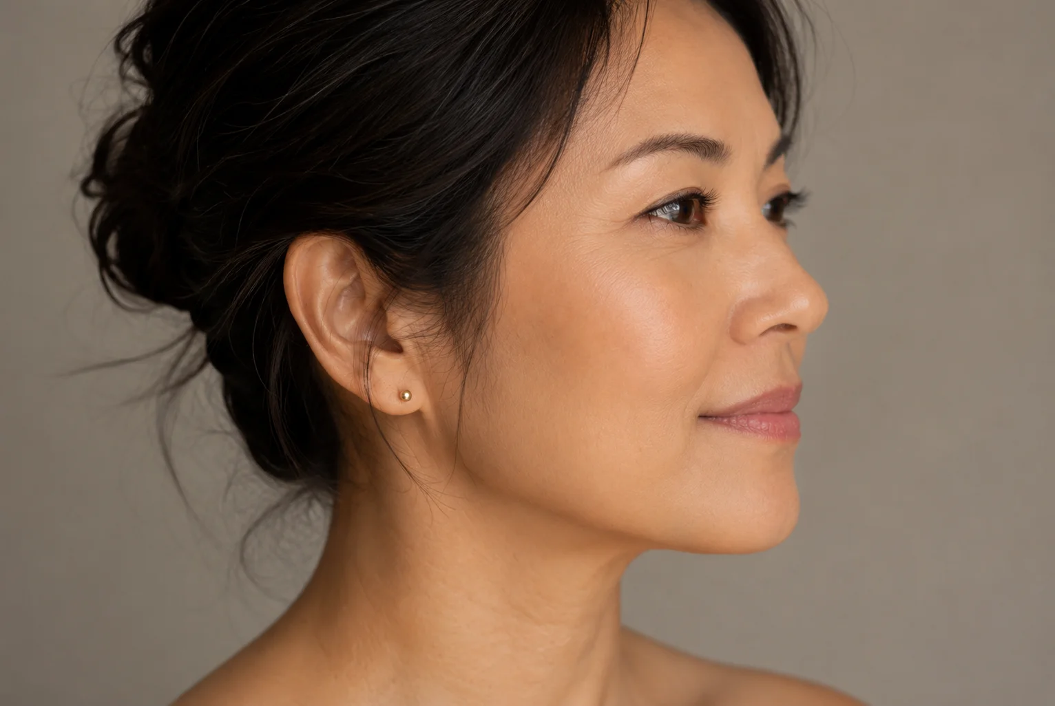 Deep Neck Lift Areas Treated